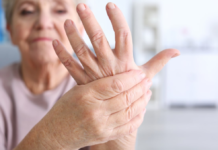 Что нужно знать об артрите?