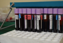 Чужая кровь. Так ли нужны доноры в современном мире, вызывают ли кроводачи привыкание и кому нужна кровь