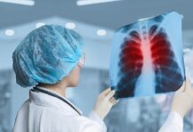 Врач смотрит на снимок легких