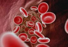 Гемофилия: какие симптомы должны насторожить и когда стоит обратиться к врачу