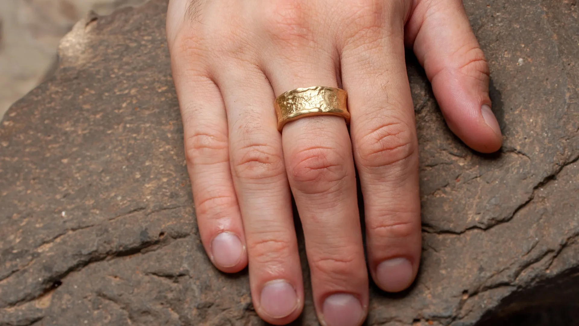 Ювелирная работа: в Борисове спасатели помогли мужчине снять кольцо